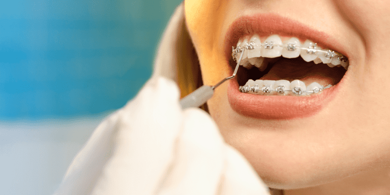 Brackets